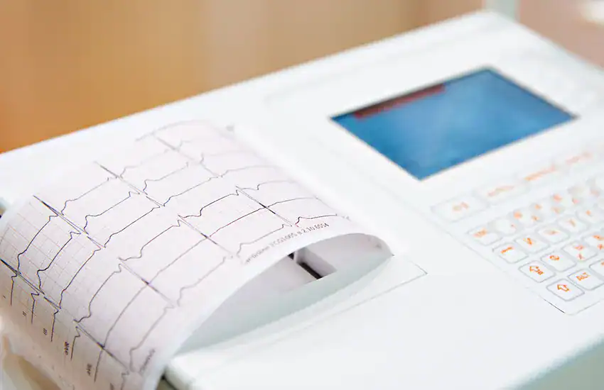 Ekg Machine