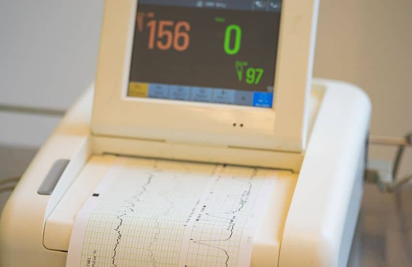 An Aging Ekg Machine That Might Be Showing Signs Of Wear.